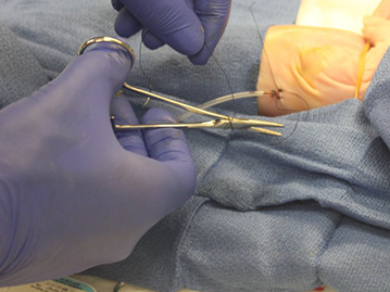 Suturing Lines and Catheters